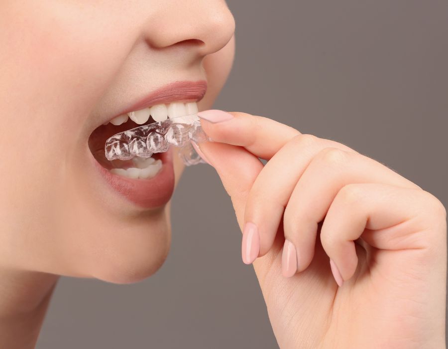 ortodoncia invisible en Clinica Dental en Alicante