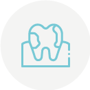 Sarro dientes